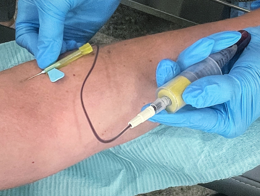 Blood collection as the first stage of a PRP treatment with PAL3 Medical